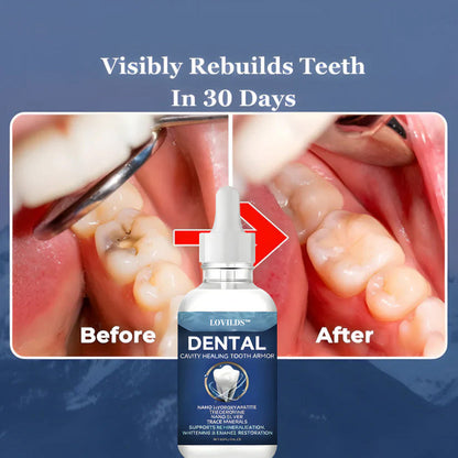 LOVILDS™ Advanced Enamel Repair & Whitening Kit (Includes Free LED Mirror)